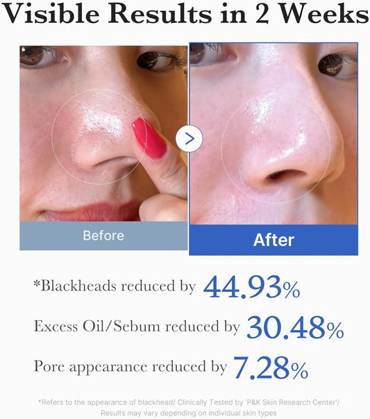 Medicube Pads Exfoliants Zéro Pore 2.0 - 70 pads