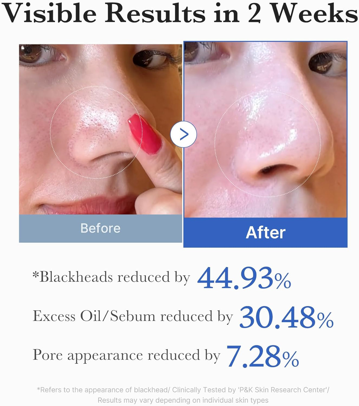 Medicube Pads Exfoliants Zéro Pore 2.0 - 70 pads