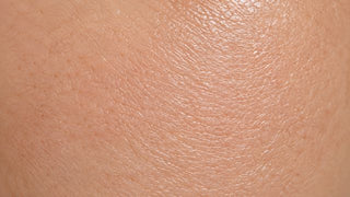 Type de peau mixte